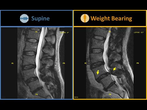 Belly Up or Down What are we missing? Prone vs. Supine MRI